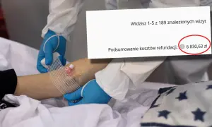 Podsumowanie kosztów refundacji: 6 830,63 zł. Czy to koszt zabiegu entropium?