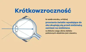 Krótkowzroczność: czy da się wyleczyć? Prawda o korekcji i hamowaniu.