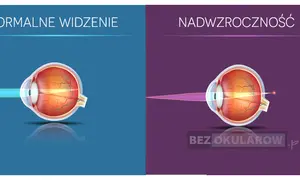 Plusy na recepcie? Zrozum dalekowzroczność i jak ją korygować