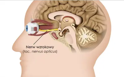 Przekrój głowy ukazujący oko i nerw wzrokowy. Zanik nerwu wzrokowego rokowania może wpływać na widzenie.
