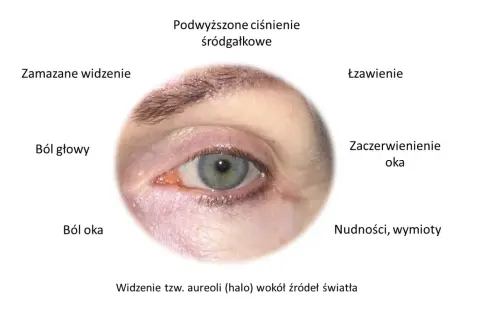 Objawy jaskry: ból oka, łzawienie, zaczerwienienie, zamazane widzenie, bóle głowy, nudności, widzenie aureoli. Czy jaskra jest uleczalna? Wczesne wykrycie kluczowe.