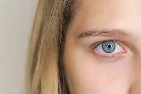 Błękitne oko z rozszerzonymi źrenicami, otoczone jasnymi włosami.