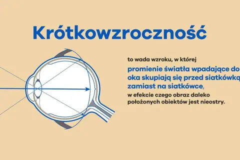 Krótkowzroczność: czy da się wyleczyć? Prawda o korekcji i hamowaniu.