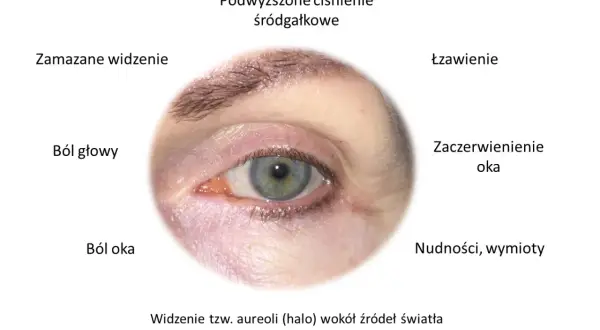 Objawy jaskry: ból oka, łzawienie, zaczerwienienie, zamazane widzenie, bóle głowy, nudności, widzenie aureoli. Czy jaskra jest uleczalna? Wczesne wykrycie kluczowe.