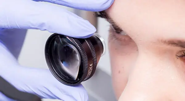 Rękawiczka z soczewką zbliża się do oka, przygotowując do laseroterapii siatkówki.