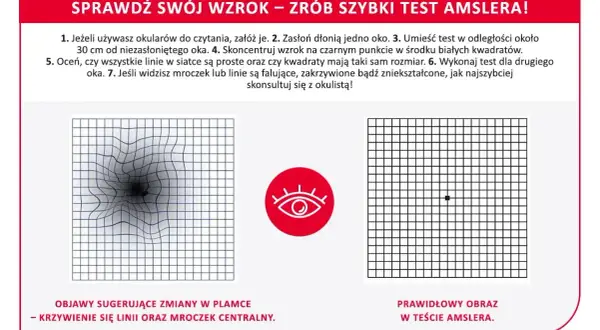 Falowanie obrazu w oku może być objawem zmian w plamce. Test Amslera pokazuje zniekształcone linie, sugerując problemy ze wzrokiem.