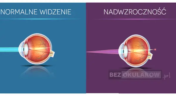 Plusy na recepcie? Zrozum dalekowzroczność i jak ją korygować