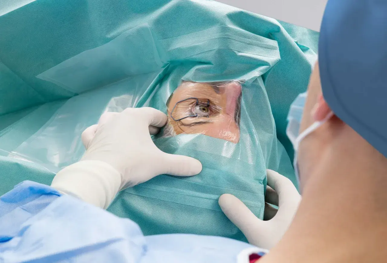 Oko pacjenta podczas zabiegu laserowej korekcji wzroku, przygotowywane przez chirurga w rękawiczkach.