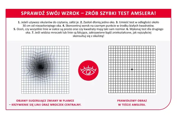 Test Amslera pokazuje zniekształcone linie i mroczek, sugerując problemy ze wzrokiem. Prawidłowy obraz jest prosty.