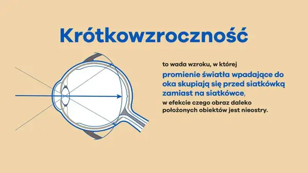 Krótkowzroczność: czy da się wyleczyć? Prawda o korekcji i hamowaniu.